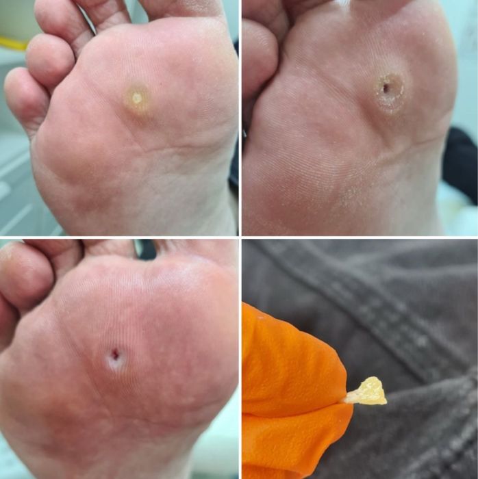 Услуги  подолога