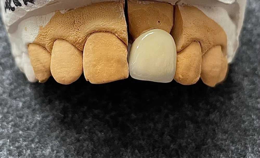 CAD/CAM технология зубного техника