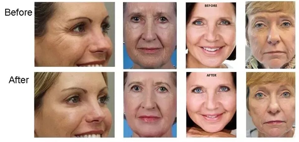 Комплект капсули Гел против стареене GLOWSKIN 0+ за кислородна терапия