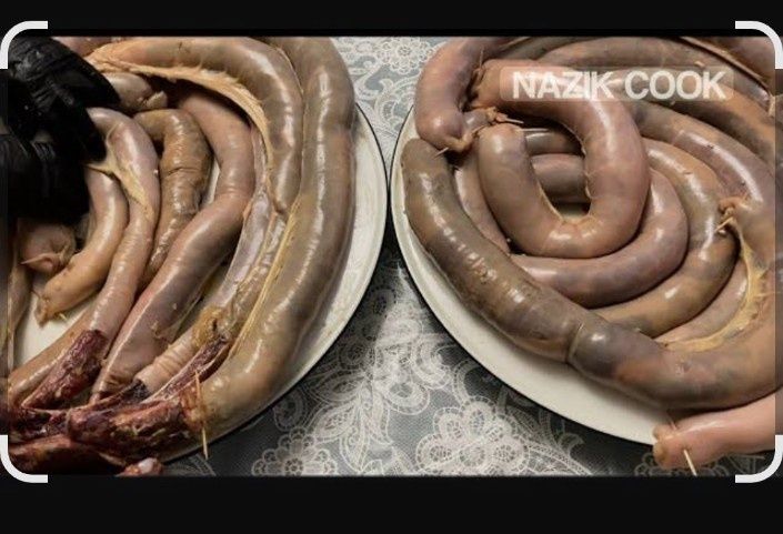 Казы айналдыру, шек қарын ашу