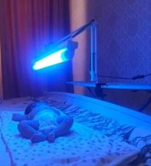 Аренда фото лампы для лечения желтушки у новорождённых