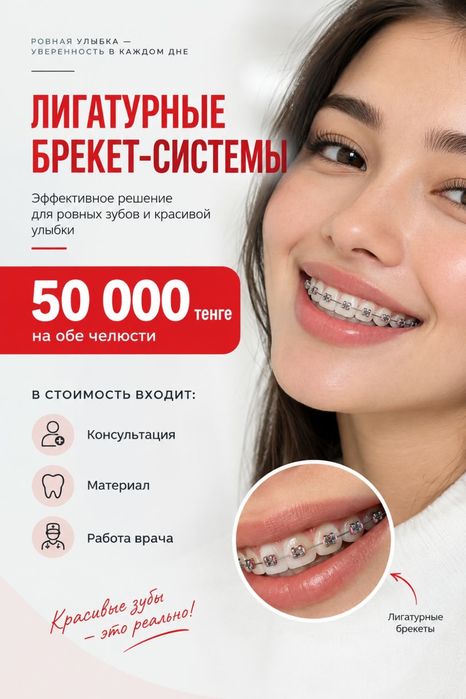 Лигатурные брекеты