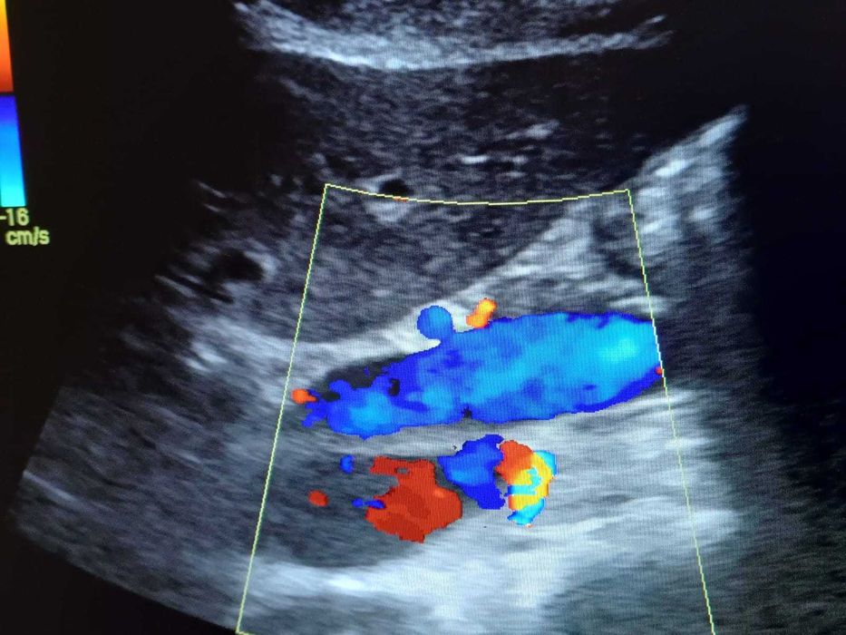 Ecograf stationar GE Logiq F6 cu trei sonde in stare excelenta