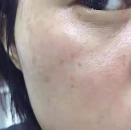 SKIDKA NARXDA !!! dastavka bor.