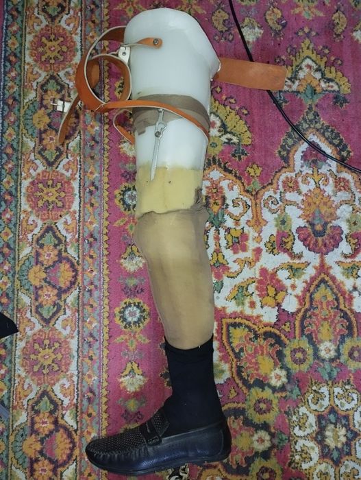 Протез левой ноги выше колени