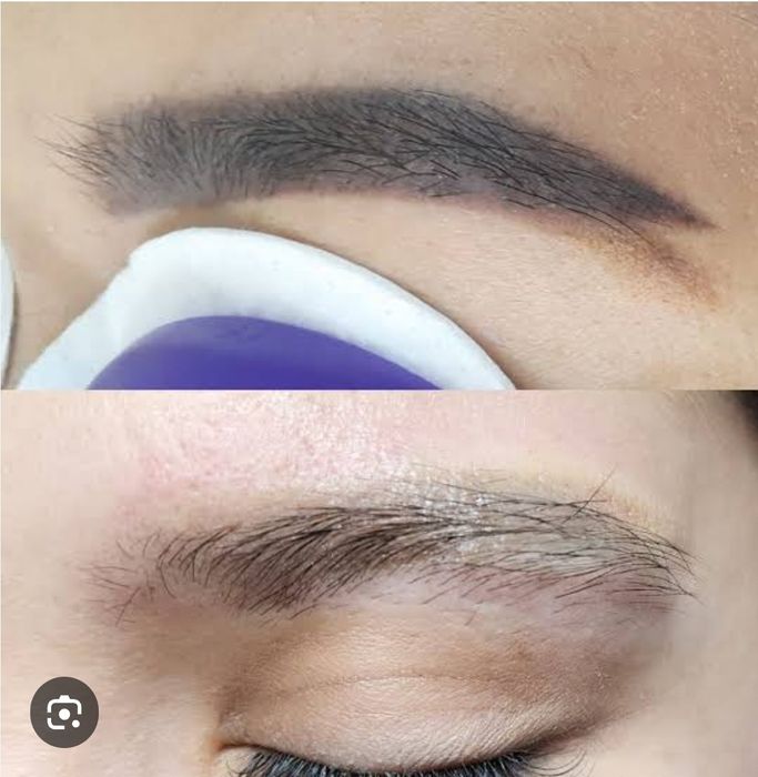 Удаление татуажа бровей.Татуаж учириш.