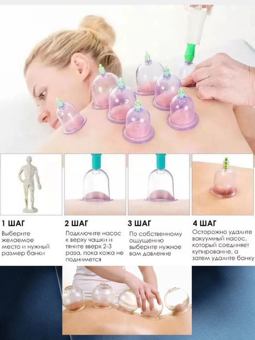 Банка для хиджамы 12шт Xijoma bonka 12шт