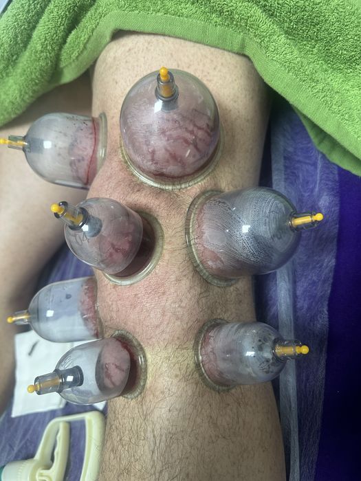 Оздоровительная хиджама