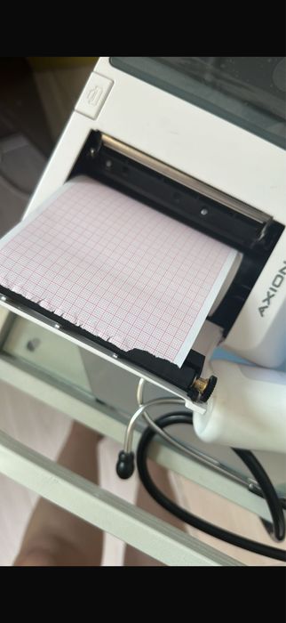 Электрокардиограмма