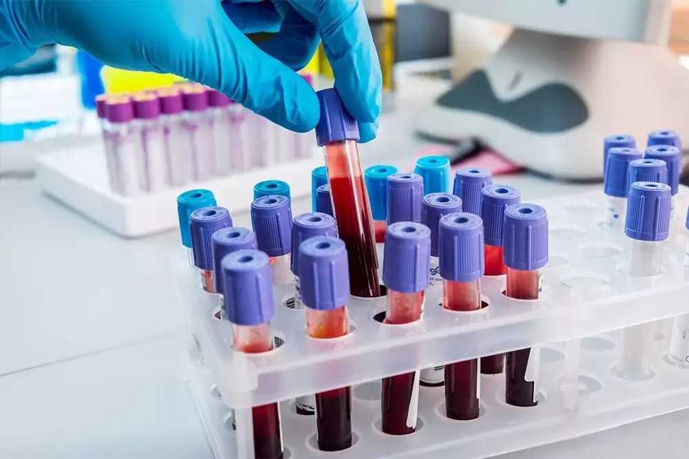 Îngrijiri Medicale la Domiciliu 24/7 – Consultații, Perfuzii, Paliative | București Ilfov