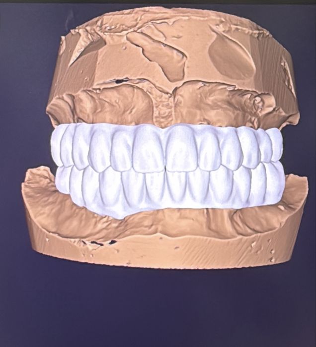 Зуботехнические услуги