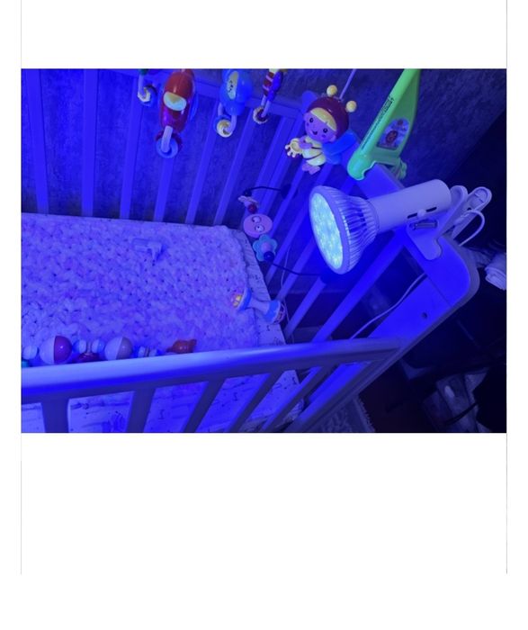 Фотолампа от желтушки