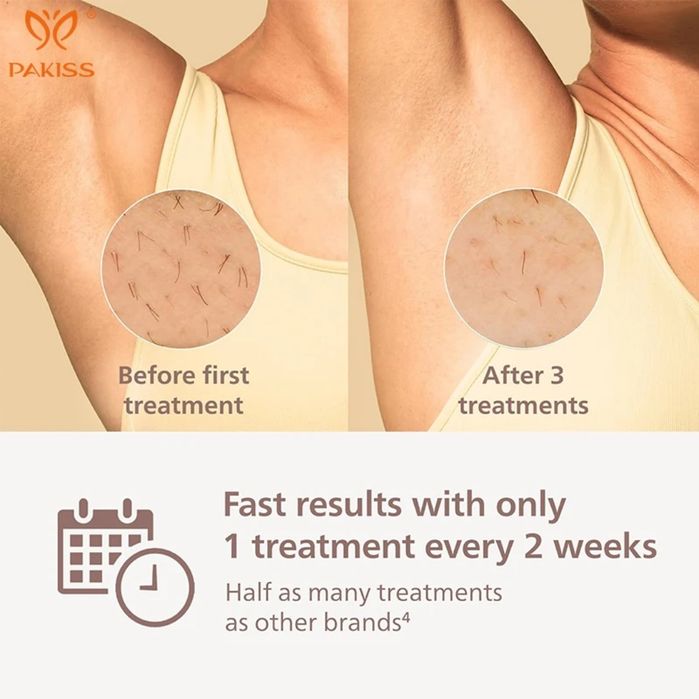 (Sf-70) Аппарат для лазерной эпиляции IPL для женщин