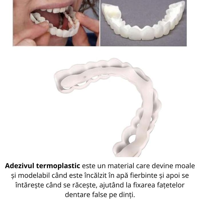 Set fatete dentare, superioare si inferioare, fatete cosmetice cu gel