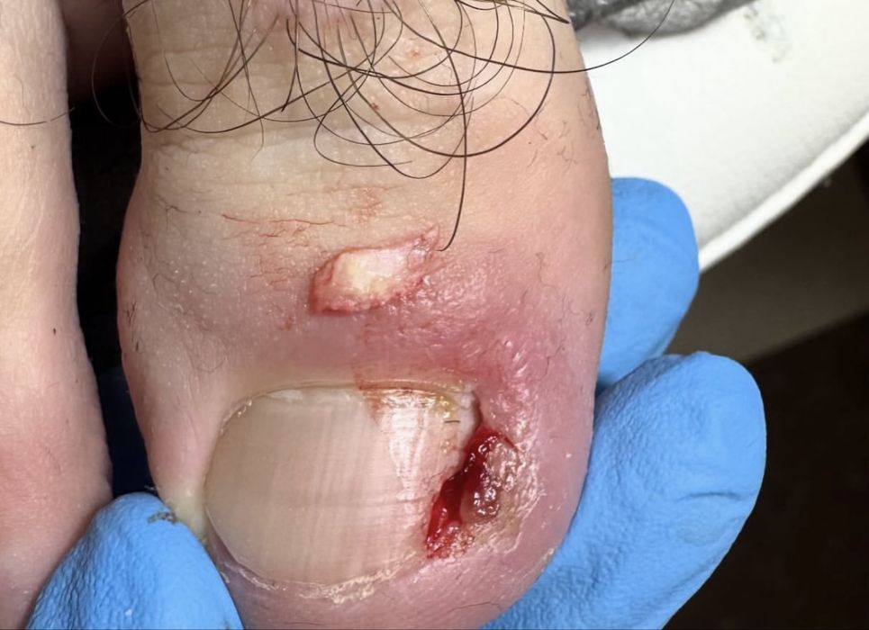 Мужской педикюр от А до Я