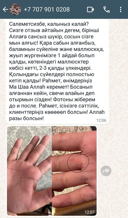 Тері аураларына қолдан қайнатылады