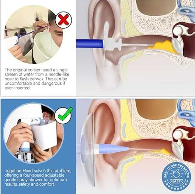 Set de curatare a urechilor, 4 moduri de presiune