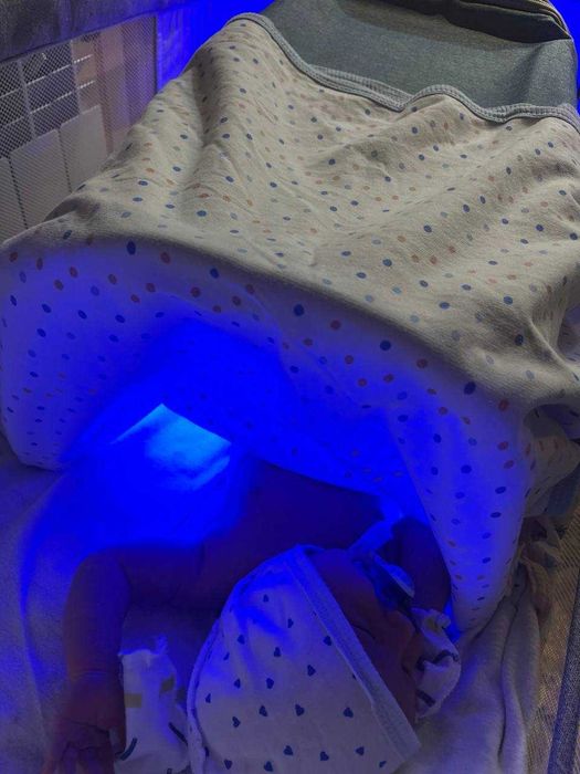 Fotolampa - chaqaloq uchun xavfsiz yorug'lik terapiyasi,Фотолампа куез