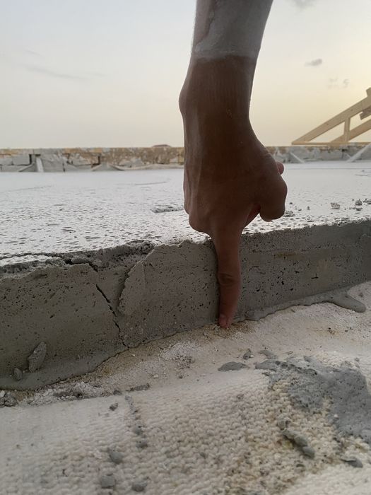 Pena lomboz xizmatlari