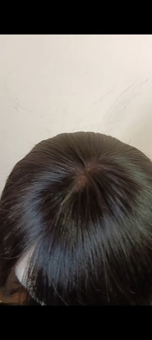 Макушка сотилади