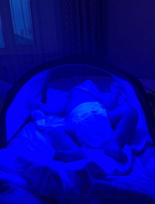 Фотолампа от желтушки