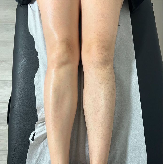 Обучение шугаринг