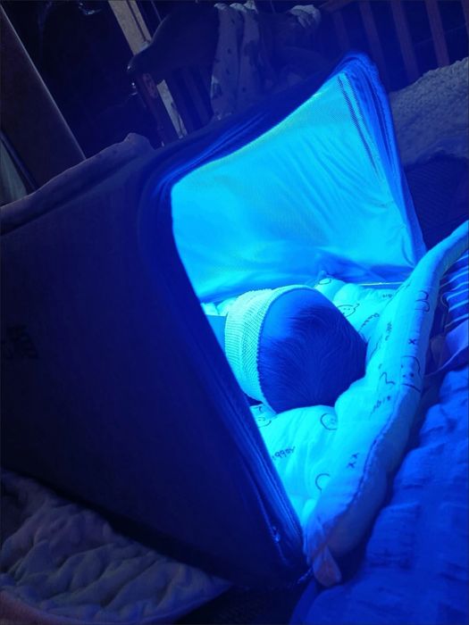 Уф лампа от желтушки