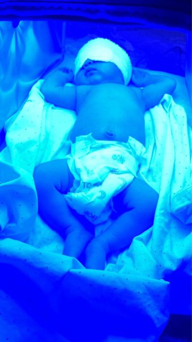 Фотолампа от желтушки