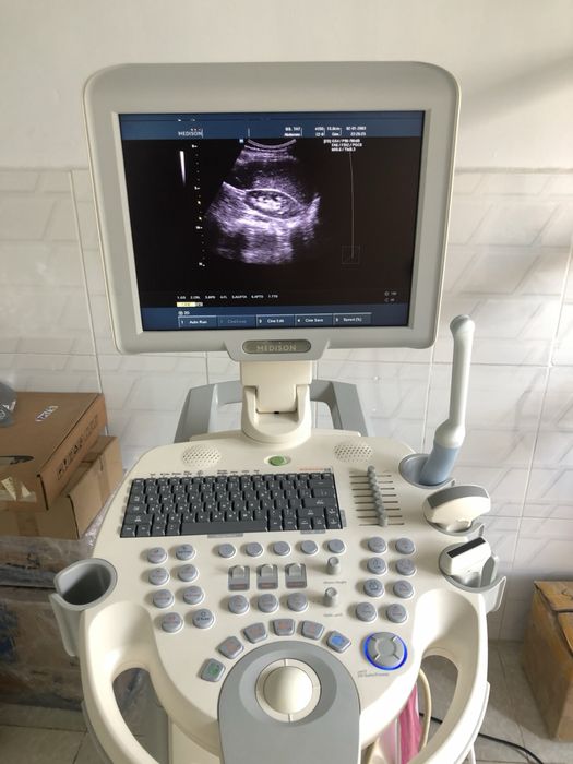 Сдам в аренду узи аппараты.