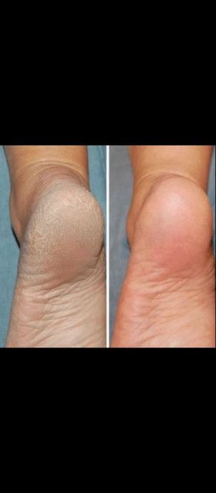 ПОДОЛОГ 22 года стаж