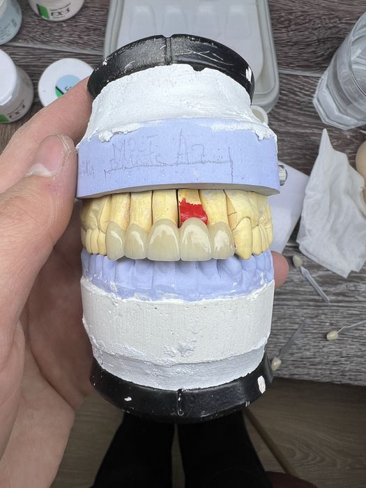 Зубной техник