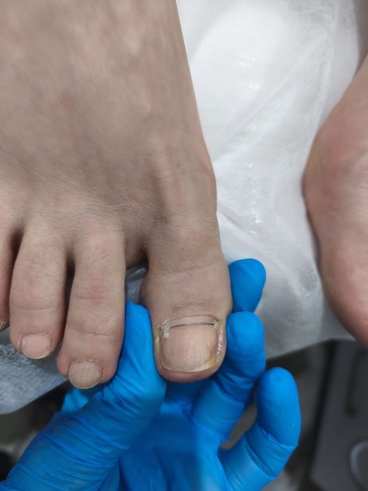 Педикюр для всех