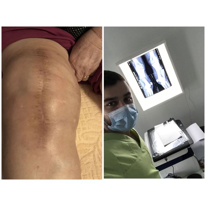 Kinetoterapie la Domiciliu