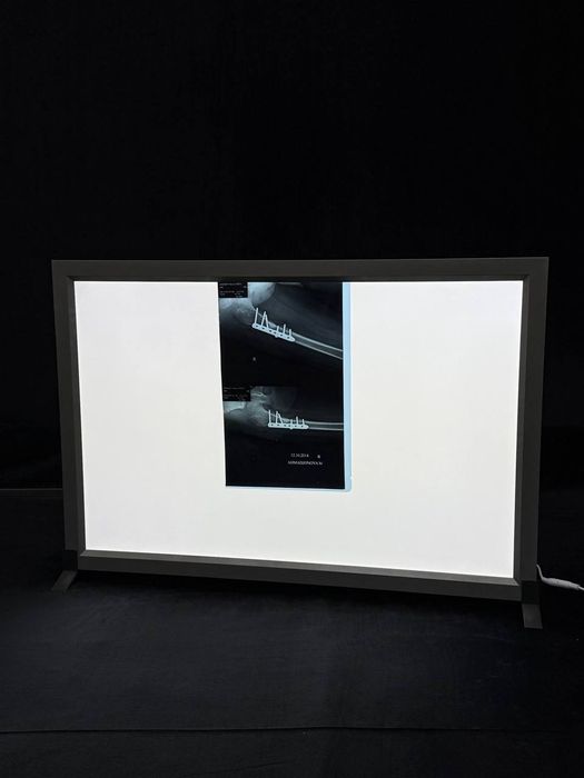 Негатоскоп (большой, 2-х кадровый)