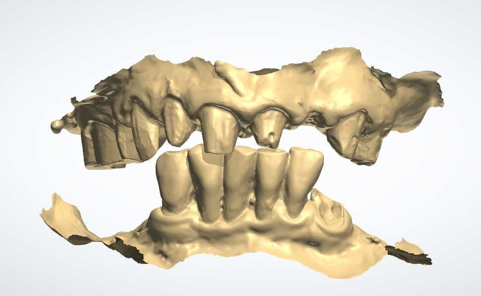 CAD/CAM дизайн |Корони, мостове, барове| 3Shape | Blender for Dental |