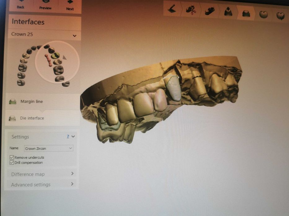 Зъботехнически скенер 3shape d700