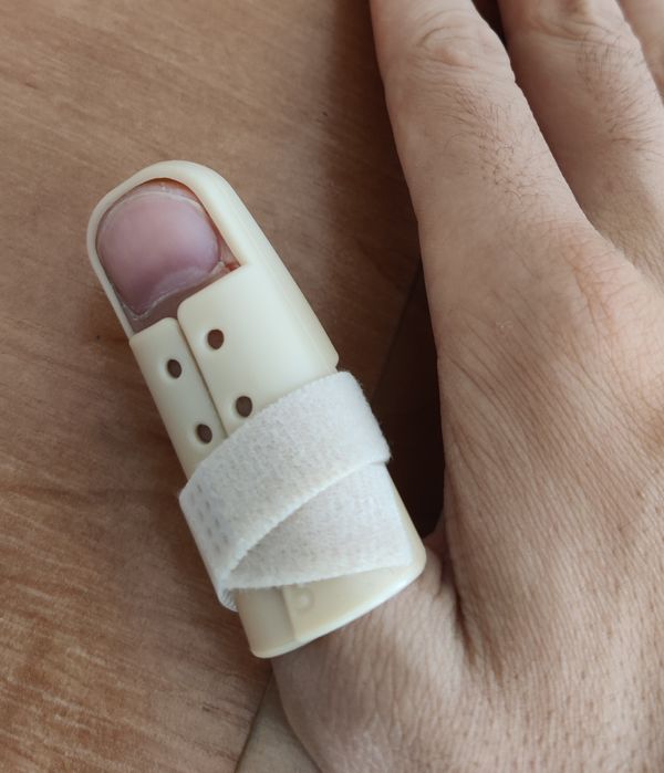 Лонгета на палец при переломах