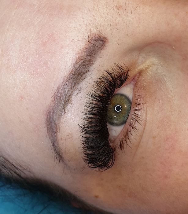 Extensii gene Timisoara