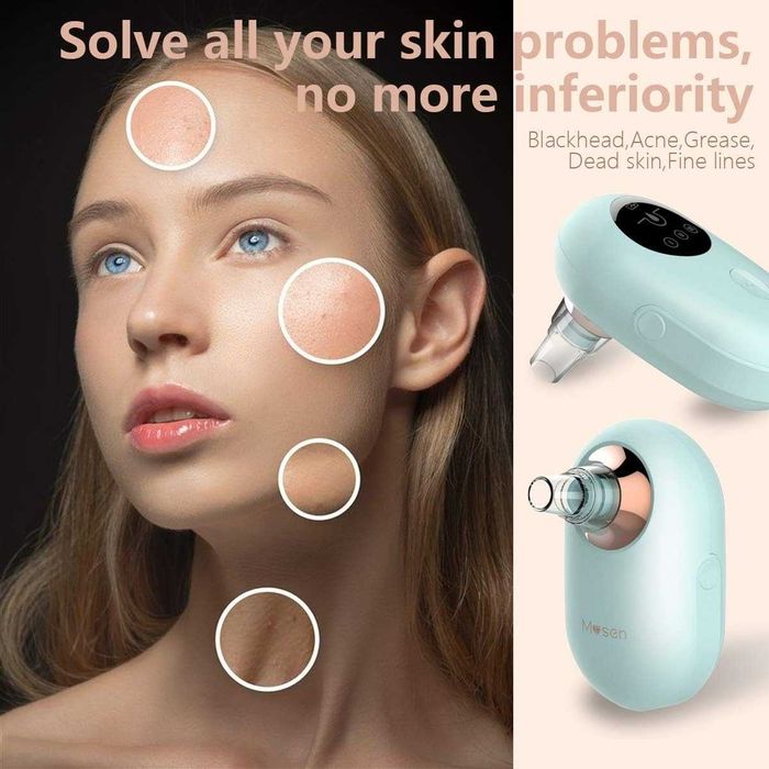 Професионален уред за почистване на порите на лицето Mosen