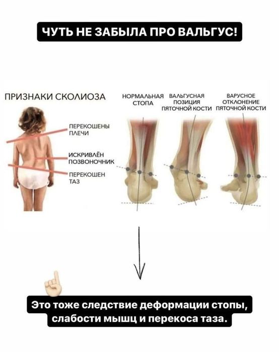 Стельки коррекционные в наличии
