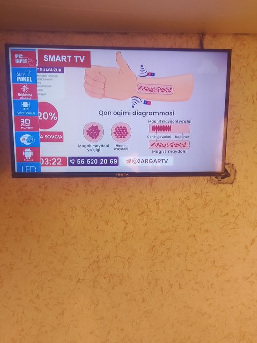 Телевизор смарт андроид  ва оддий  сотилади ишлашига Гап йок