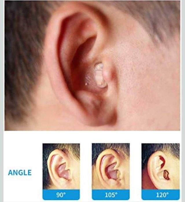 Мини CIC слухов апарат (за дясно ухо) Марка: TKING нов с 2 батерии