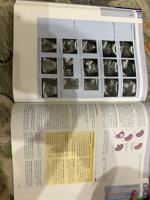 Differential Diagnosis in Ultrasound Imaging (carte ultrasonografie)