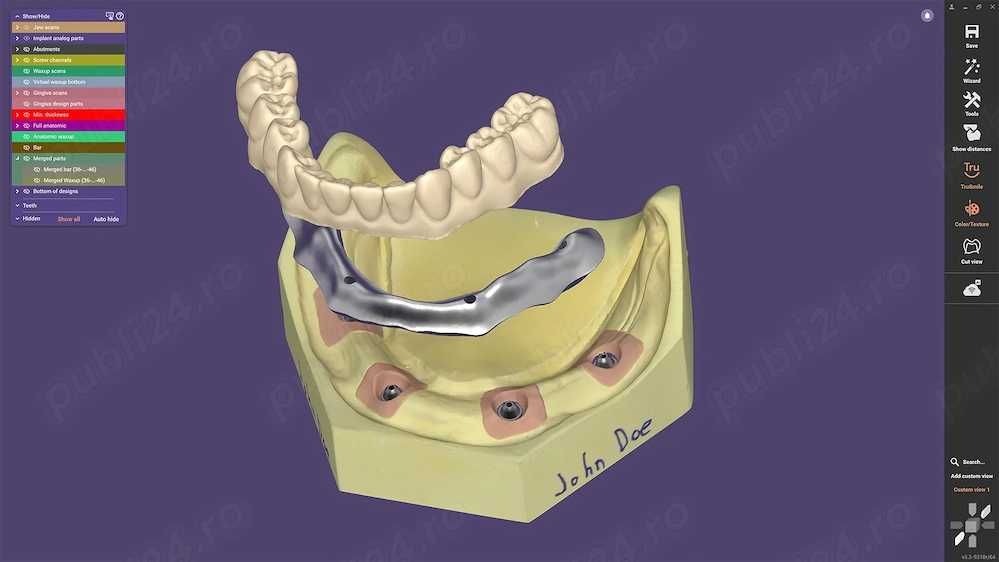 Exocad 3.3 varianta full