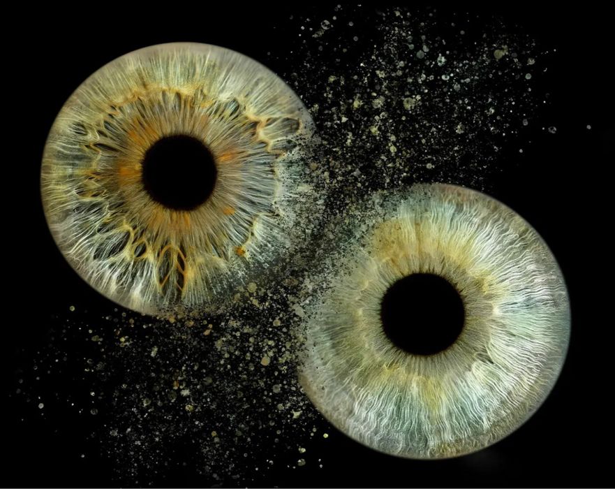 Фото радужки глаз