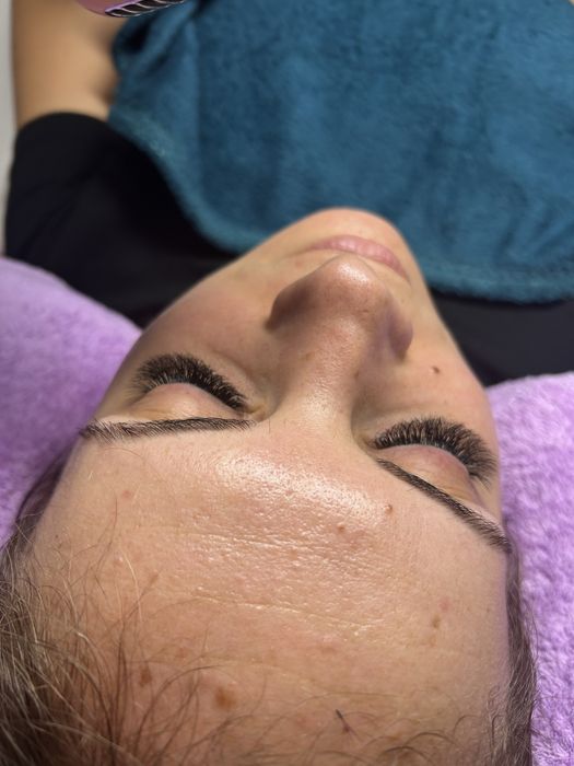 Extensii de gene Rogerius