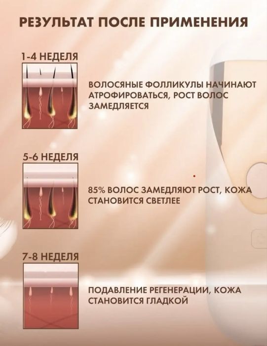 Фотоэпилятор в отличном состоянии