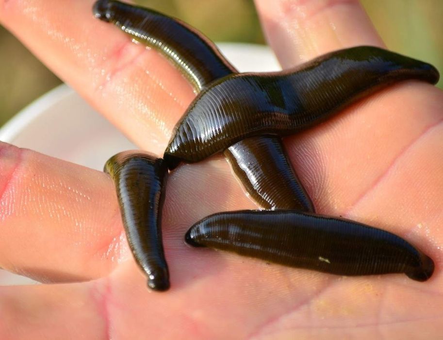 Zuluk Tibbiyot Zuluklari  Пия́вки