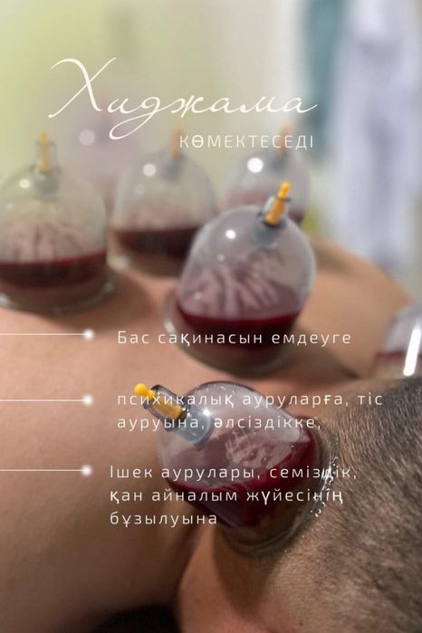 Хиджама Шымкент!!!