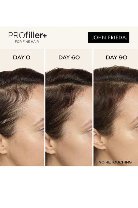 John Frieda PROfiller+ Hair Growth Scalp Serum - 50ml